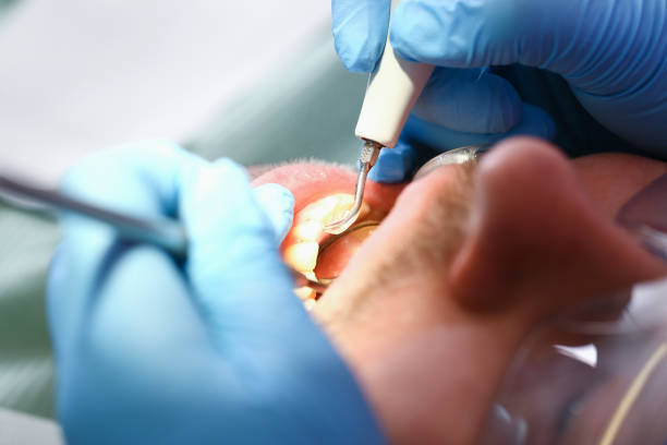 Best Emergency Pediatric Dental Care in Darnestown, MD